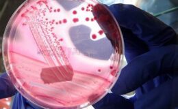 Prostat Kanseri Farkındalığı ve Erken Teşhise Yönelik Klinik Gelişmeler – Prof. Dr. Yiğit Akın Görüşleri