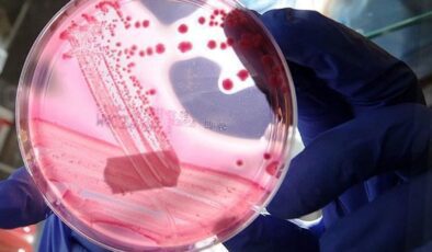 Prostat Kanseri Farkındalığı ve Erken Teşhise Yönelik Klinik Gelişmeler – Prof. Dr. Yiğit Akın Görüşleri