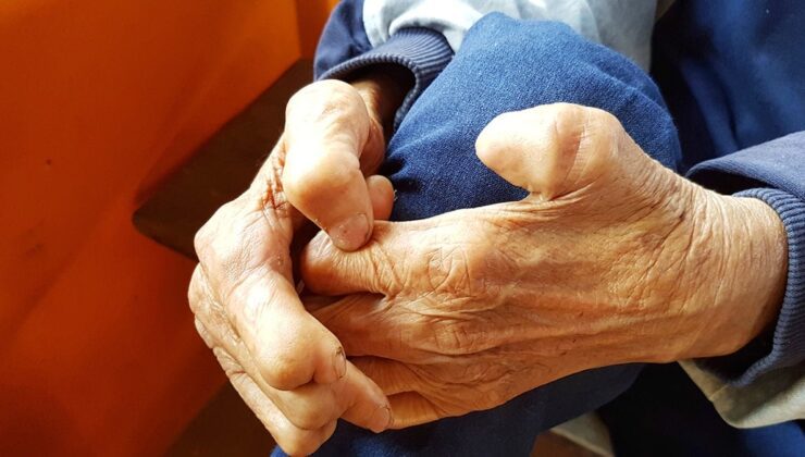 Sarkopeniye Karşı Erken Yaşlardan Başlayan Koruma ve Yaşam Tarzı Yaklaşımları